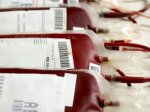 Главного врача станции переливания крови в Хакассии уличили в мошенничестве.